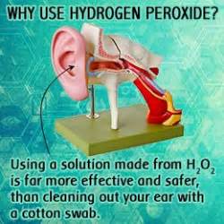 hydrogen peroxide  earwax removal cleanses