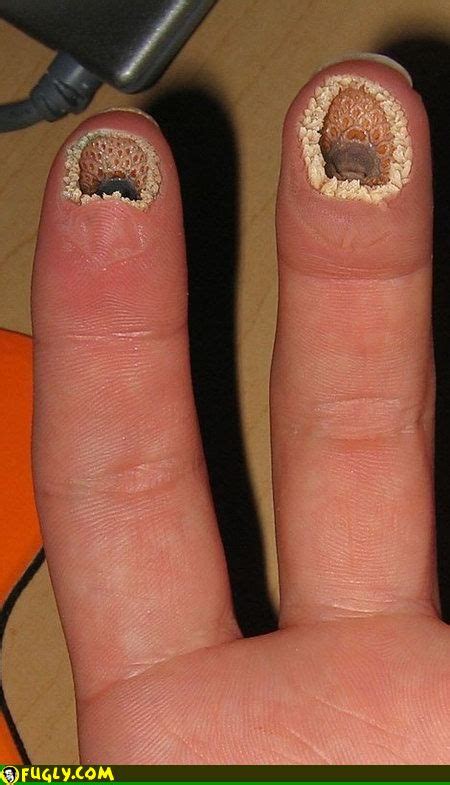 fingers hurt gross images fugly