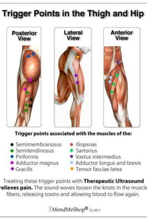 Trigger Points Are Ischemic Areas In The Muscle Apply