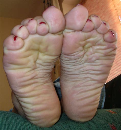 wrinkled soles toes