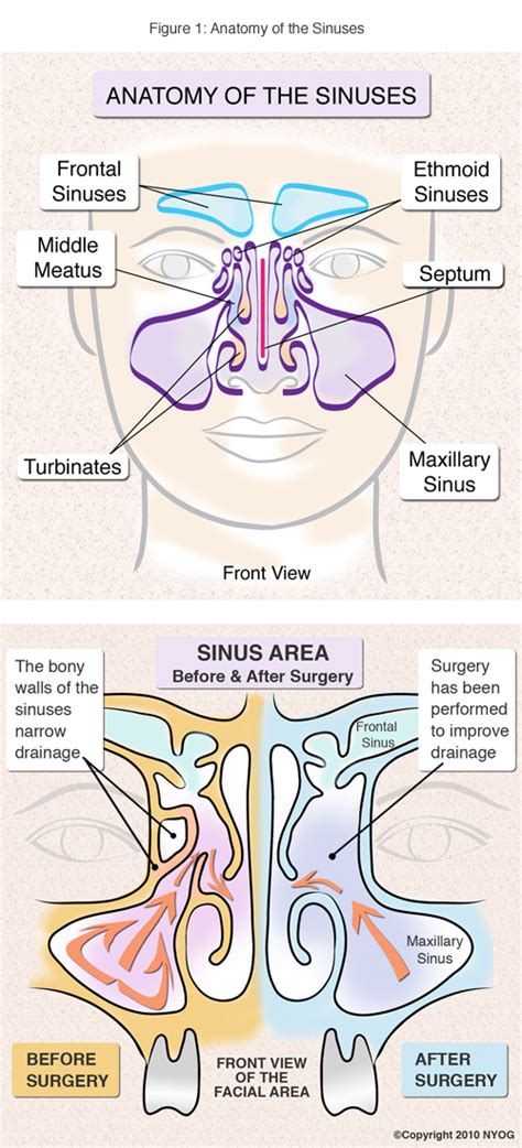 sinus anatomy check   helpful diagram ny sinus center