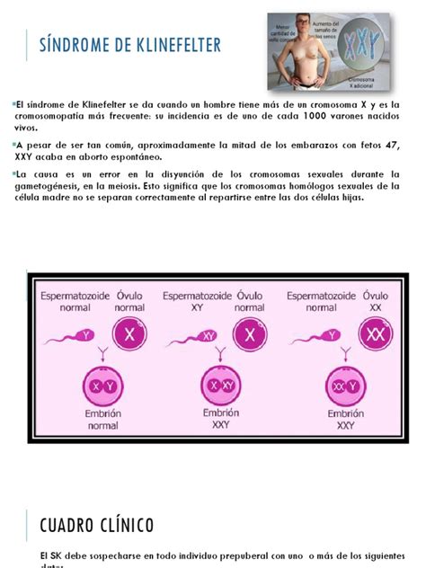 Síndrome De Klinefelter Pdf Enfermedades Y Trastornos Medicina