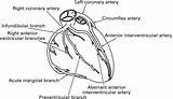Heart Coronary Anatomy Fallot Tetralogy Arterial Figure Correlations Morphological Clinical Larger Version Large Bmj sketch template