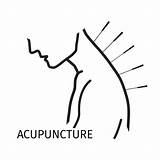 Acupuncture Illustration Vector Logo Clip Icon Acupuncturist Line Chinese Illustrations Needles Point Stock Points Chiropractor Style Depositphotos Similar Feet Needle sketch template