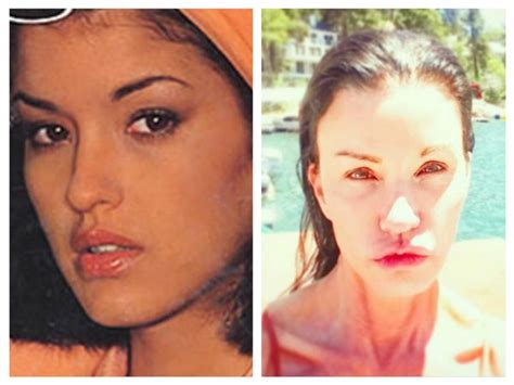 20 Worst Cases Of Celebrity Plastic Surgery Gone Wrong