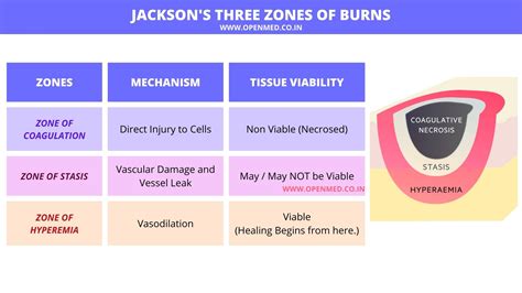 jacksons  zones  burns