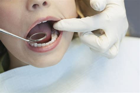 maintaining oral hygiene   healthy life dental services