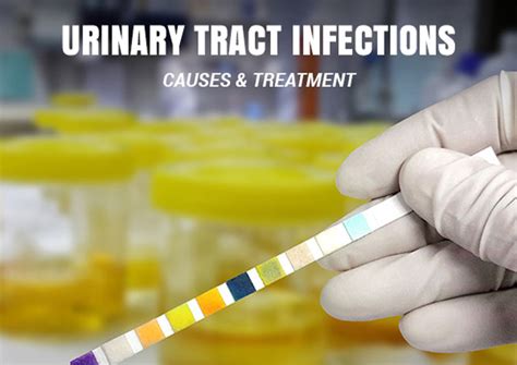 Urinary Tract Infections Causes And Treatment For Women