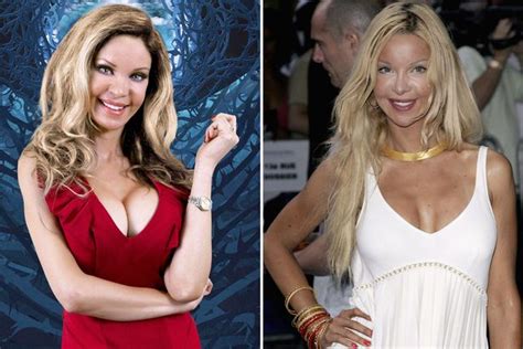 Breast Implants Nose Jobs And Filler Dramatic Celebrity
