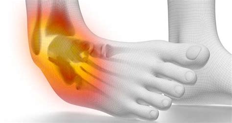 acute ankle injuries sprains fractures symptoms
