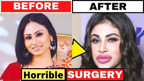 shocking plastic surgery  bollywood actresses   part