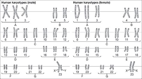 karyotyping current perspectives in diagnosis of chromosomal disorders veerabhadrappa sk