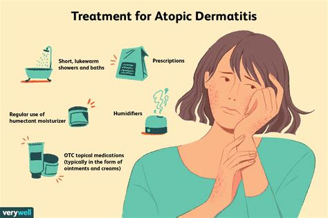 atopic dermatitis  treated