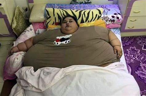world s fattest woman weighs 79 stone daily star