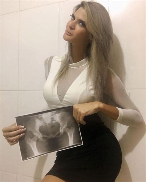 Miss Bumbum Contestants Pose With X Rays Of Their Massive
