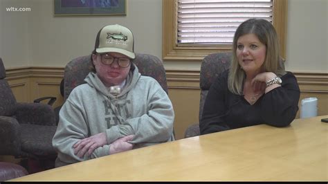 Sumter Teen S Progress While Recovering From Burn Injuries