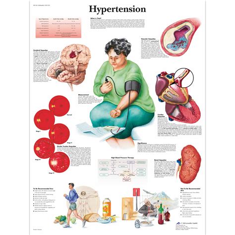 hypertension chart  vruu cardiovascular system