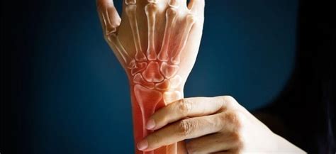 hand injuries decatur il wrist injuries carpal tunnel syndrome
