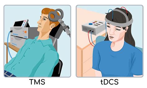 tdcs  tms whats  difference whats    caputron