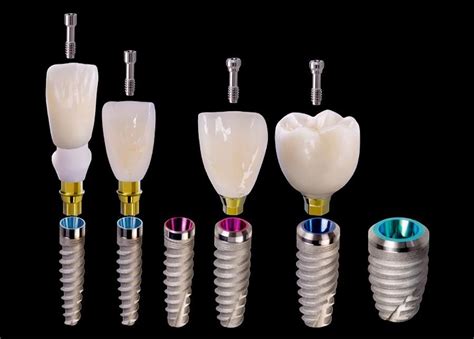 implantology  hahn tapered implant system combines clinically
