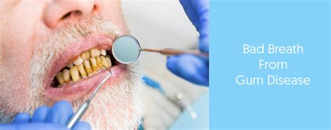 how do you get rid of bad breath from gum disease dental aware australia