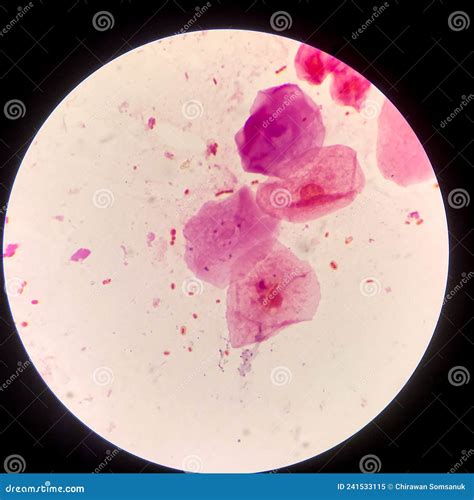 Bacteria Cell Gram Neagative Bacilli With Capsule Sample Sputum In Gram