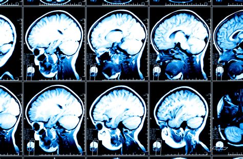 the brain scan image and the dangers of brain porn big think