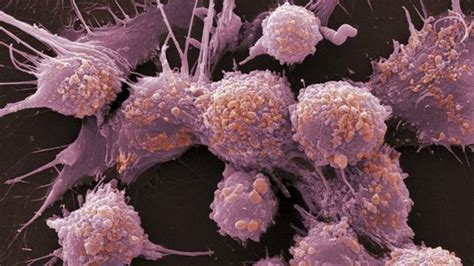 prostate cancer drug ruling a fiasco says charity bbc news