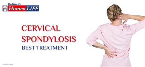 Cervical Spondylosis Treatment In Homeopathy Homeolife