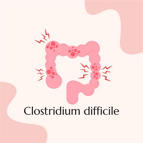 clostridium difficile helisa laboratorium