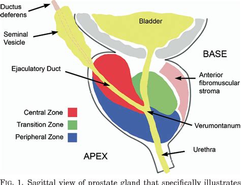 Central Zone Prostate Mri Prostate Sector Map As Anterior