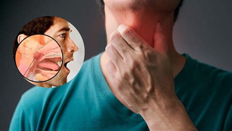 throat cancer  unusual symptoms  larynx cancer   show