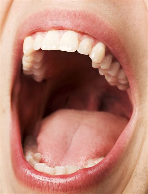 Let Us Now Consider Dental Patient Napkin Holders – New Dentist Blog