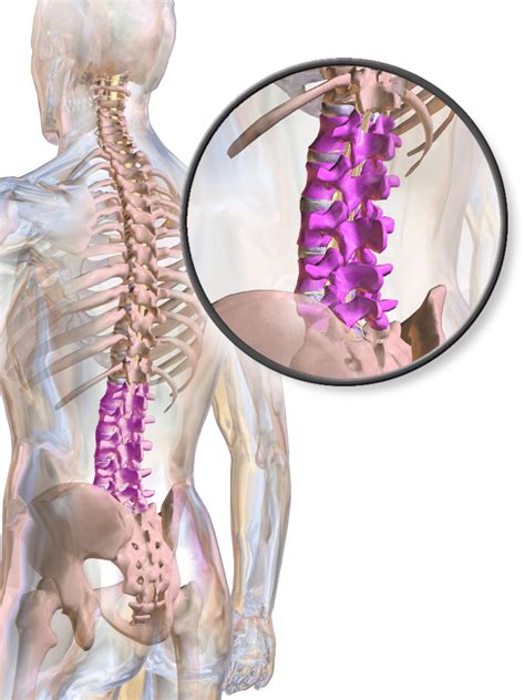 lumbar disc access lumbosacral   specialty spine care