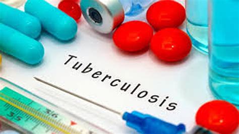todo lo  hay  saber de la tuberculosis una infeccion