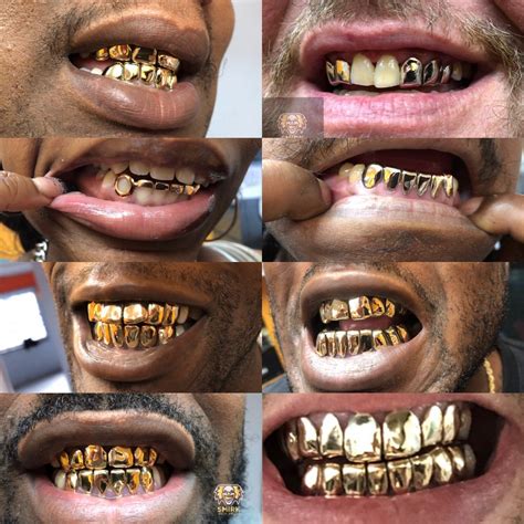 gold grillz smirkgoldgrillz