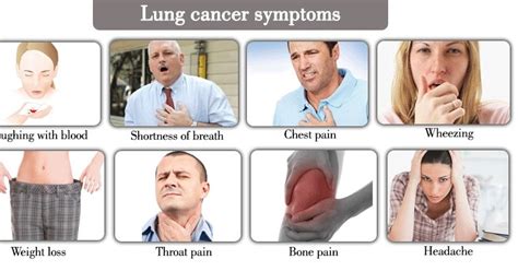 symptoms of lung cancer on different stages canceroz