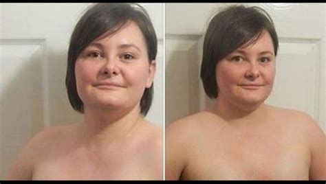 Woman Refuses To Remove Photos Of Her Double Mastectomy Scars Says
