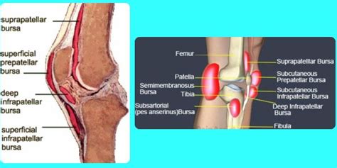 knee bursitis recovery time  experience injury health blog