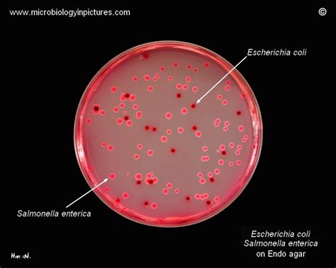 ecoli  salmonella enterica  endo