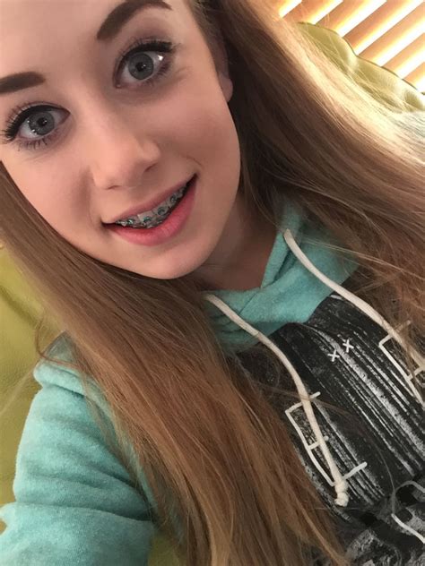 orthodontics teen selfie nude