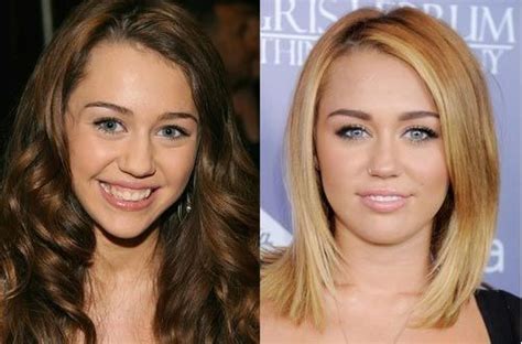 pin by liam parkson on celebrity photos celebrity surgery celebrity plastic surgery plastic