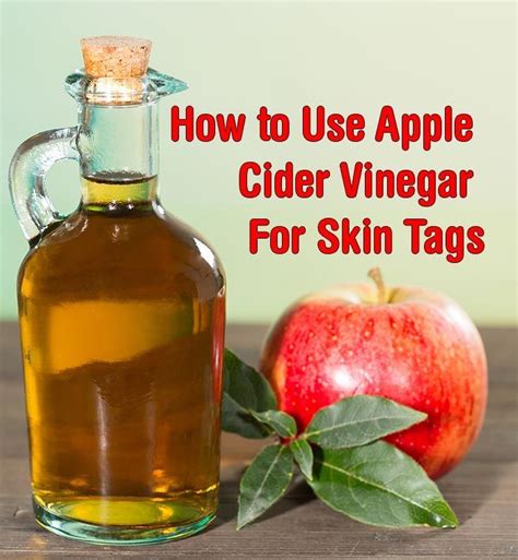 how to use apple cider vinegar for skin tags healthy focus
