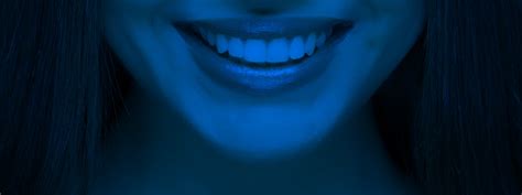 teeth whitening  dallas  white dental spa