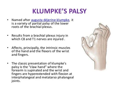 klumpke palsy symptoms  treatment   relief