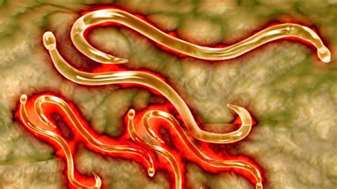 4 signs you re infected with a parasite howstuffworks