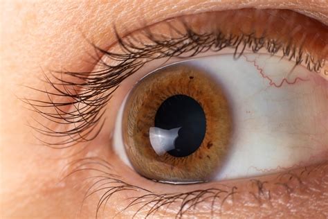 Common Age Related Eye Diseases