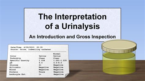 interpretation   urinalysis part  introduction  inspection