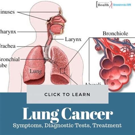 Lung Cancer Symptoms Diagnostic Tests And Treatment