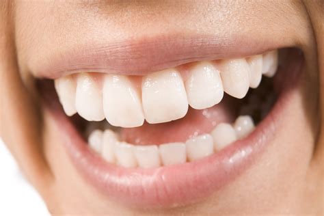 tooth enamel erode